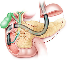 ERCP_Jan_2019_001